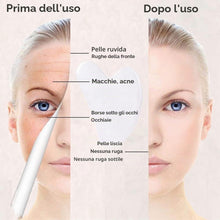 Carica l'immagine nel visualizzatore di Gallery, Gua Sha, Gua Sha Viso Ridurre le Linee Sottili e le Rughe, massaggi per terapia fisica e terapia di agopuntura per viso,