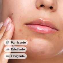 Carica l'immagine nel visualizzatore di Gallery, The Ordinary Salicylic Acid 2% Solution 30ml, Siero Acido Salicilico, Ad azione mirata per pelle soggetta a imperfezioni