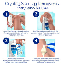 Carica l'immagine nel visualizzatore di Gallery, Cryotag Skin Tag Remover – Rimozione Rapida ed Efficace dei Fibromi Penduli – Rimuove i le Escrescenze della Pelle in un