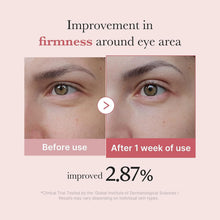 Carica l'immagine nel visualizzatore di Gallery, medicube Eye Serum with Salmon DNA PDRN &amp; Pink Peptides