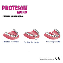Carica l'immagine nel visualizzatore di Gallery, Protesan Mono - Riparatore per Dentiere Spezzate, Incrinate o Che Hanno Perso un Dente