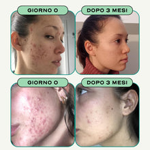 Carica l'immagine nel visualizzatore di Gallery, Circles CLEAR Integratore Pelle Donna Zinco Bardana Ortica 60 Capsule