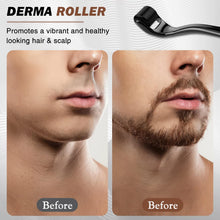 Carica l'immagine nel visualizzatore di Gallery, Dermaroller Capelli, Microneedling Derma Roller,Micro-Ago Roller 540-Aghi Rullo Derma per Crescita Dei Capelli,Trattamen