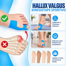Carica l'immagine nel visualizzatore di Gallery, 30 pezzi di Kinesiotape per Alluce Valgo, Tape Kinesiologico Pre-tagliato per Correzione e Sollievo dal Dolore, Traspira
