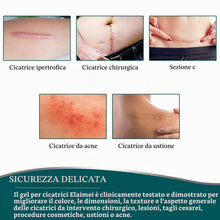 Carica l'immagine nel visualizzatore di Gallery, Cerotti in Silicone per Cicatrici (4cm x 300cm) – Rotolo in Silicone Medico per Trattamento Cicatrici da Interventi, Tag