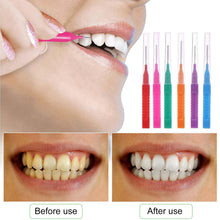 Carica l'immagine nel visualizzatore di Gallery, 30 Pezzi Scovolini Interdentali, Scovolino Per Pulizia Denti con Coperchio, Scovolino Interdentale Per L'Igiene Lnterden