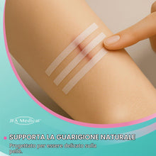 Carica l'immagine nel visualizzatore di Gallery, JFA Medical Set di 150 strisce di sutura sterili per ferite, 6 x 75 mm