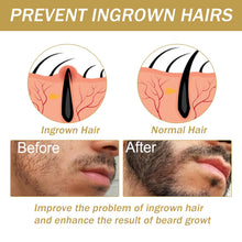 Carica l'immagine nel visualizzatore di Gallery, Kit Per La Crescita Della Barba,Kit Crescita Barba Uomo