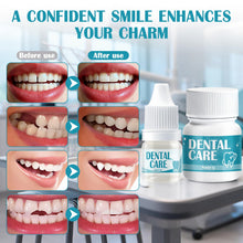 Carica l'immagine nel visualizzatore di Gallery, Cemento Dentale Definitivo, Colla per Denti, Calore e Impermeabile