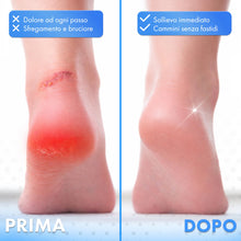 Carica l'immagine nel visualizzatore di Gallery, Copritalloni in Silicone Morbido Antisfregamento e Anti Vesciche, Protezione Tallone Ammortizzante, Lavabili e Riutilizz