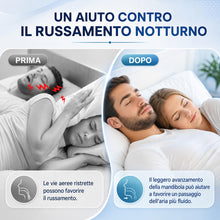 Carica l'immagine nel visualizzatore di Gallery, Bocchino Antirussante Regolabile–Design Leggero e Confortevole.Riduce efficacemente il russare