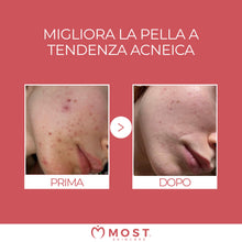 Carica l'immagine nel visualizzatore di Gallery, MOST - Glicosal Esfoliante Viso Micropeeling, Lozione con Acido Salicilico e Acido Glicolico - Delicata Azione Peeling V