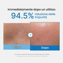 Carica l'immagine nel visualizzatore di Gallery, medicube Zero Pore Blackhead Deep Cleansing Oil