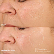 Carica l'immagine nel visualizzatore di Gallery, Kleem Crema Viso Antirughe Acido ialuronico con Retinolo e Collagene