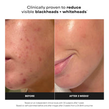 Carica l'immagine nel visualizzatore di Gallery, Paula's Choice SKIN PERFECTING 2% BHA Esfoliante Liquido