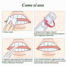 Carica l'immagine nel visualizzatore di Gallery, Penna Sbiancante Denti professionale, Immediato Liquido Sbiancante Denti, Efficace che Rimuove Macchie e Ingiallimento, 