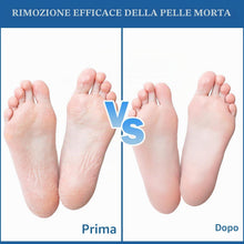 Carica l'immagine nel visualizzatore di Gallery, VEGCOO 60 Pezzi Ricambi per Lima Pedicure, Cuscinetti Abrasivi, Carta Vetrata Ricarica, Rimuovere la Pelle Morta, da Bag
