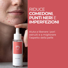 Carica l'immagine nel visualizzatore di Gallery, MOST - Glicosal Esfoliante Viso Micropeeling, Lozione con Acido Salicilico e Acido Glicolico - Delicata Azione Peeling V