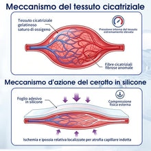 Carica l'immagine nel visualizzatore di Gallery, Cerotti Silicone Cicatrici Medicale, Rotolo 4 cm × 1,8 m