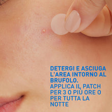 Carica l'immagine nel visualizzatore di Gallery, CeraVe Patches Idrocolloidali Anti Brufoli, Non Lascia Segni, 22 Pezzi