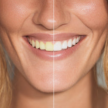 Carica l'immagine nel visualizzatore di Gallery, GELDIS Whitening Strips WHITEGlow, Striscie Sbianca Denti, 28 strisce per 14 giorni, Rimuove Macchie Superficiali, Delic