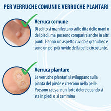 Carica l'immagine nel visualizzatore di Gallery, Evolsin Penna-antiverruca contro le verruche, 3 ml