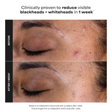 Carica l'immagine nel visualizzatore di Gallery, Paula's Choice SKIN PERFECTING 2% BHA Esfoliante Liquido