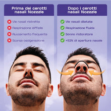 Carica l'immagine nel visualizzatore di Gallery, Nozzzle Dilatatore Nasale Magnetico Antirussamento - Starter Kit 30 Giorni: 4 Misure + 60 Cerotti + Applicatore - Stop R