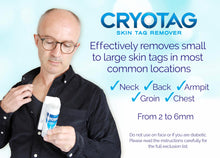 Carica l'immagine nel visualizzatore di Gallery, Cryotag Skin Tag Remover – Rimozione Rapida ed Efficace dei Fibromi Penduli – Rimuove i le Escrescenze della Pelle in un
