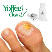 Carica l'immagine nel visualizzatore di Gallery, Yoffee Clear – Trattamento ristrutturante per migliorare la salute delle...