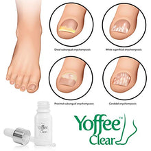 Carica l'immagine nel visualizzatore di Gallery, Yoffee Clear – Trattamento ristrutturante per migliorare la salute delle...