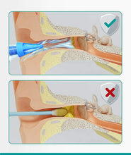 Carica l'immagine nel visualizzatore di Gallery, Medi Grade Kit Siringa Pulisci Orecchie – Siringa per Tappi Orecchie con 3 Punte